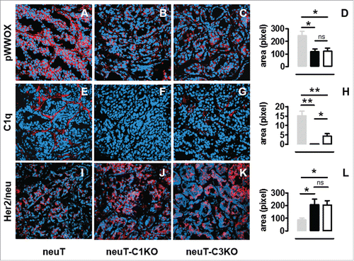 Figure 4. Decrease of pWWOX and increase of Her2/neu expression in neuT-C1KO tumors. Confocal microscopy images of frozen tumor sections from neuT (A, E, I), neuT-C1KO (B, F, J), and neuT-C3KO (C, G, K) mice (n = 7 per group) labeled with anti-pWWOX (red, A–C), anti-C1q (red, E–G), and anti-Her2/neu (red, I–K) antibodies. Nuclei were stained with TO-PRO®-3 iodide (blue). Magnification ×100. pWWOX (D), C1q (H), and Her2/neu (L) protein quantification was performed in neuT (gray bar), neuT-C1KO (black bar), and neuT-C3KO (white bar) mice (*p = 0.02 for pWWOX; *p = 0.04 and **p = 0.009 for C1q; *p ≤ 0.04 for Her2/neu; two-tailed Student's t-test). Results are represented as means ± SEM from 3 × 400 microscopic fields per sample.