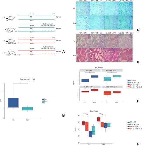 Figure 3 Validation of marker species related cytokine regulations and evaluation of the effect of IL-6 in lung injury. (A) On the fifth week after BMT, infection with PA or MHV started, IL-6 treatments were applied at the 4, 5, 6, 7 days post-infection. BAL and tissues were harvested at the 8-day post-infection. (B) BAL levels of IL-6 in WT→ WT mice infected with PA or MHV. N=10/group. (C) Immunolocalization of IL-6 in lungs after mice infected with PA or MHV. No immunostaining was observed in IL-6 KO → WT mice. N=3/group. (D) H&E staining of lungs after mice infected with PA or MHV. N=3/group. (E and F) Total protein in BAL of different groups of mice, in two presentation forms. (E) Comparison of total protein levels between PA and MHV infected mice. (F) Comparison of total protein between mice with IL-6 KO marrow or WT marrow; between mice with IL-6 KO marrow before or after IL-6 treatment. N=5/group. *P < 0.05, **P < 0.01, and ***P < 0.001.