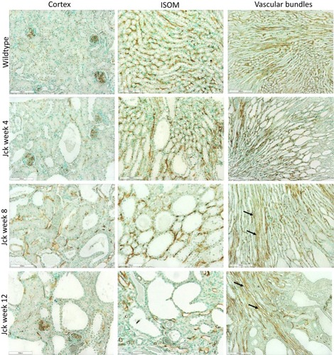 Figure 5 Photomicrographs showing vascular remodelling and angiogenesis using CD34 immunostaining in jck mice. The images from top to bottom show wild-type mice at week 4 and jck mice at weeks 4, 8 and 12, and the respective vessels of the cortex (first column, 200x), ISOM (centre column, 200x) and vascular bundles (last column, 100x).