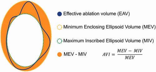 Figure 1. Calculation of ablation volume irregularity (AVI) of effective ablation volumes (EAV). MEV: minimum enclosing ellipsoid volume,;MIV: maximum inscribed ellipsoid volume.