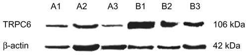 Figure 2 Representative Western blotting of three determinations (mean ± standard error of the mean, bottom). P < 0.05 versus A1–3.