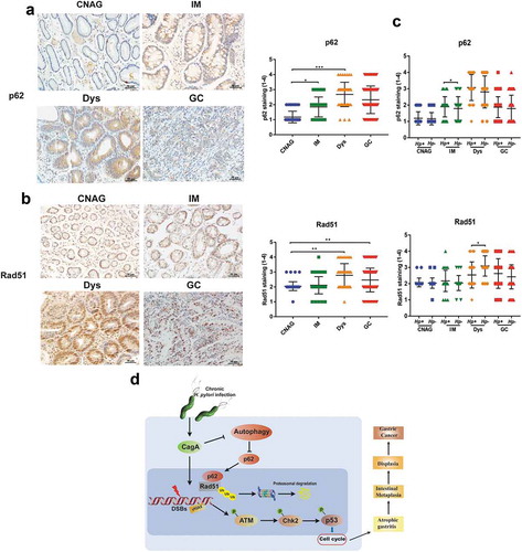 Figure 8. The expression of p62 and Rad51 in the human gastric carcinogenesis cascade (a, b) Immunohistochemical staining for p62 and Rad51 in serial tissue sections from human gastric mucosa with different stages (CNAG, IM, Dys and GC) of the Correa histopathological cascade. (c) Expression levels of p62 and Rad51 were compared between H. pylori+ and H. pylori- gastric tissues with different stages (CNAG, IM, Dys and GC) of the Correa histopathological cascade. (d) Models of the regulation of autophagy-DNA damage axis in response to H. pylori infection. **P < .01, ***P < .001. All experiments were independently repeated three times.