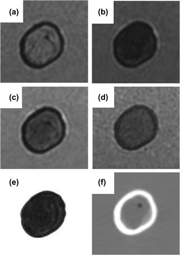 Figure 1. Example transversal images of the deer femoral bone positioned in the gelatine; (a) T1/T2*-weighted FGE in-phase, (b) T1/T2*-weighted FGE out-of-phase, (c) T1/T2*-weighted FGE water-only, (d) T1-weighted SE, e) T2-weighted FSE, and (f) CT.