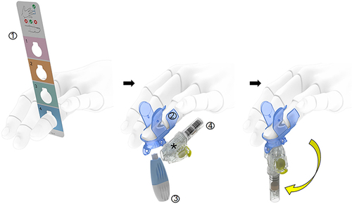 Figure 1 Schematic depicting the BD MiniDraw collection system used to facilitate capillary blood collection for this study. (1) Measurement of finger size was conducted using the BD MiniDraw Finger Sizing Tool; (2) The BD MiniDraw Finger Sleeve includes a guiding port to situate the (3) finger lancing mechanism and the proper position and wings to control both squeeze pressure and location; (4) The BD MiniDraw SST Capillary Blood Collection Tube collection tube or the BD MiniDraw H&H Capillary Blood Collection Tube. *With the pre-attached, disposable collector.