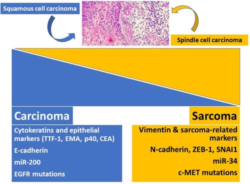 Figure 1 A concise scheme illustrating the balance of epithelial-to-mesenchymal transition markers in sarcomatoid carcinoma sustained by up- and down-regulation of different molecules and gene alterations governing the tumor cell cellular program.