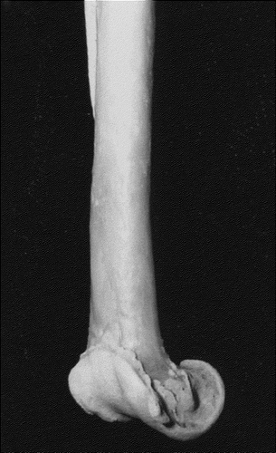 Figure 11. Medial oblique view of black-throated diver (Gavia arctica) distal tibiotarsus. Overgrowth at joint margin forming osteophytes of osteoarthritis.