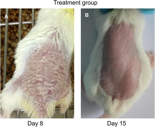 Figure 2 Images of skin of mice in the Treatment group (A) prior to treatment (Day 8) and (B) after treatment (Day 15). After 7 days of treatment with TGP the skin lesions have resolved and the skin appears normal (B).