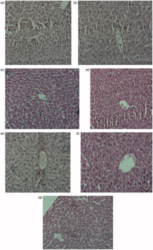 Figure 4. Histoartictecture of the liver of acetaminophen treated mice following oral administration of Phyllanthus muellarianus aqueous leaf extract. (A) control, (B) acetaminophen (c) 400 mg/kg b.w extract (d) 100 mg/kg b.w extract + acetaminophen (e) 200 mg/kg b.w extract + acetaminophen (f) 400 mg/kg b.w extract + acetaminophen (g) 200 mg/kg b.w sylimarin + acetaminophen.