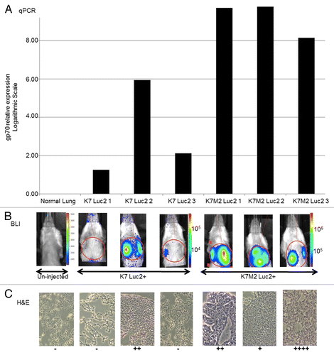 Figure 4. Comparison of gp70-specific qPCR, bioluminescence and histological methods to detect osteosarcoma cells in vivo. (A–C) BALB/c mice (n = 3 per group) were injected with 106 firefly luciferase (Luc2)-expressing K7 or K7M2 cells in the proximal tibia. (A) Relative expression levels of gp70-coding transcripts as detected by quantitative reverse-transcriptase PCR (qPCR) in the whole lung tissues of individual tumor-bearing animals 28 d after the inoculation of cancer cells. (B) Whole mouse bioluminescence imaging (BLI) of the same tumor-bearing mice indicated above, immediately prior to lung harvesting (28 d after cancer cell inoculation). Red circles represent the regions of interest (ROIs) that were employed to quantify BLI signal intensity. (C) Histological examination of tissue sections from the lungs harvested from the same tumor-bearing animals analyzed in panels (A and B). Visible lung tumor nodules were scored in 15 consecutive sections of each individual lung, with “−” means no tumor detected in any of the 15 slides, and the number of “+” represent the maximum number of tumor nodules seen in a single slide.