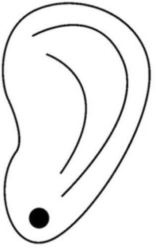 Figure 1 Auricular acupuncture points.