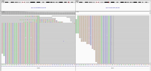 Figure 3 Integrative genomics viewer snapshot of FGFR2-BICC1. Alignment of NGS sequencing reads from the patient’s tumor reveals a FGFR2-BICC1 rearrangement.