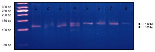 Figure 1 Lane 1 shows DD genotypes at 103 base pairs, lanes 2–4 show ID genotype at 103 and 112 base pairs, and lanes 5–8 show II genotypes at 112 base pairs using a 50-base pair ladder.