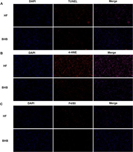 Figure 4 BHB prevented from cardiomyocyte apoptosis and macrophage infiltration. (A) DHE staining, (B) TUNEL staining and (C) F4/80 immunofluorescence were performed between groups.