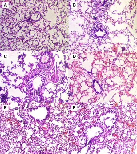 Figure 7 Effect of embelin on lung histopathology (photographs of selected parts were taken at 10× magnifications). (A) normal control (B) OVA-LPS-induced asthmatic disease control (C) OVA-LPS + embelin (12.5 mg/kg), (D) OVA-LPS + embelin (25 mg/kg), (E) OVA-LPS + embelin (50 mg/kg) and (F) OVA-LPS + dexamethasone (2.5 mg/kg)-treated rats.