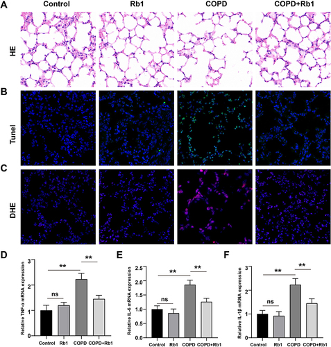 Figure 6 Rb1 alleviated CSE-induced lung injury, apoptosis, oxidative stress and inflammation in rats. (A) Pathological changes of lung tissues after injection of CSE and treatment of Rb1 using HE staining. (B) TUNEL staining detecting cell apoptosis after injection of CSE and Rb1 treatment using HE staining. (C) DHE staining measuring intracellular ROS in COPD and Rb1 treatment rats. (D–F) Relative mRNA expression levels pro-inflammatory cytokines including TNF-α, IL-6, and IL-1β. **P<0.01.