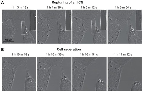 Figure 5 Phase contrast images demonstrating the coupling between intercellular membrane nanotube disconnection and cell separation. At time zero, the T24 cells were treated with 5 mM methyl-β-cyclodextrin. The disruption of intercellular membrane nanotubes was observed using time-lapse confocal microscopy for the indicated times (A). Note that the intercellular membrane nanotube (see inset) is disrupted midway and then retracted. The disconnection of intercellular membrane nanotubes, possibly due to stretching, causes the abrupt cell separation, accompanied by morphological alterations from a polygonal to a spherical cell shape (B).Note: Scale bar is 10 μm.Abbreviations: h, hours; ICN, intercellular membrane nanotube; m, minutes; s, seconds.