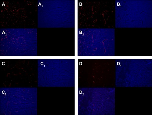 Figure 11 Antiangiogenesis analysis with CD31 immunofluorescence staining.Notes: Representative CD31 immunofluorescence images for the NS (A–A2), empty micelles (B–B2), free curcumin (C–C2), and Cur/MPEG-PLA micelles (D–D2) are shown. Groups were stained with CD31 antibody (A–D) and DAPI (A1–D1). Merged images are shown in (A2–D2).Abbreviations: NS, normal saline; Cur, curcumin; MPEG-PLA, monomethoxy poly(ethylene glycol)-poly(lactide) copolymer; DAPI, 4′,6-diamidino-2-phenylindole.