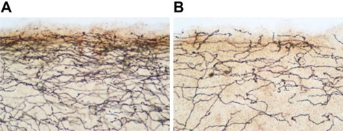 Figure 1 Photomicrograph of serotonin transporter-immunoreactive axons in the upper layers of occipital cortex of a control rat (A) compared to a 3,4-methylenedioxymethamphetamine (MDMA)-treated rat (B).