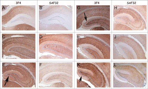 Figure 6. PrP-immunohistochemistry of hippocampus sections from infected hamsters using 3F4 and SAF32 anti-PrP antibodies. (A, B) 263K scrapie agent (IP: ∼80 dpi). (C, D) Inoculum 8.1 (1st passage; IP: 151 dpi). (E, F) Inoculum 8.1 (2nd passage; IP: 76 dpi). (G, H) Inoculum 8.2 (1st passage; IP: 246 dpi). I, J, Inoculum 8.2 (2nd passage; IP: 76 dpi). (K, L) Inoculum D (1st passage; IP: 148 dpi). The intensity of labeling for all passages was consistently stronger in the sections of animals infected with inocula 8.1, 8.2 and D compared with those of animals inoculated with 263K scrapie agent. A peculiar lamination pattern that had not previously been described in scrapie pathology can be observed in the molecular layer for inocula 8.1, 8.2 and D. This lamination is more clearly visible with the 3F4 antibody (arrows).