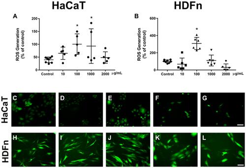 Figure 5 ROS production. Graphs and representative figures of fluorescence emitted after 72 hours of exposure in HaCat cells and HDFn cells respectively. (A) Representative graph of ROS production for HaCaT cells and (B) representative graph of ROS production for HDFn cells. Fluorescence microscopy images of HaCaT and HDFn cells of exposure to different concentrations of TiO2 NP for 72h. (C) Control HaCaT, (D) 10 µg/mL, (E) 100 µg/mL, (F) 1000 µg/mL and (G) 2000 µg/mL for the HaCaT cells. (H) Control HDFn, (I) 10 µg/mL, (J) 100 µg/mL, (K) 1000 µg/mL and (L) 2000 µg/mL for the HDFn cells. The statistical analysis was performed comparing the control group cell viability with TiO2 NP treatments by one-way ANOVA (Tuckey post-hoc); * p < 0.05.