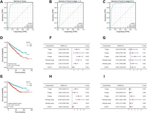 Figure 4 Diagnostic and predictive value of SLFN11. ROC curves of SLFN11 expression in normal and tumour tissues (A) and subgroup analysis of patients with pathological stages I–II (B) and III–IV (C). Kaplan–Meier analysis showed that ccRCC patients with high SLFN11 expression had shorter OS (D) and DSS (E) than those with low SLFN11 expression. Forest plots of factors and their effects on OS by univariate (F) and multivariate (G) Cox regression analyses. Forest plots of factors and their effects on DSS by univariate (H) and multivariate (I) Cox regression analyses.
