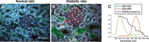 Figure 7 Multiplexed quantum-dot (QD) imaging of aldose reductase (AR) and Toll-like receptor 4 (TLR4) expressed in the kidneys of diabetic rats. AR (red arrow) and TLR4 (green arrow) were simultaneously labeled with the nano-probes – quantum dots with the emission wavelength of 605 nm (QDs-605) and quantum dots with the emission wavelength of 525 nm (QDs-525), respectively. (A) Normal rat renal tissue. (B) Diabetic rat renal tissue. The tissues were excited by ultraviolet light (the blue colors are the autofluorescence of tissues). (C) QD emission spectrum.Note: Scale bars: 100 μm.