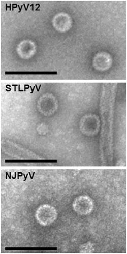 Fig. 1 Electron microscopy of HPyV12, STLPyV and NJPyV virus-like particles (VLPs) produced in Spodoptera frugiperda cells.The expected size of VLPs is 45–50 nm. Scale bars, 100 nm
