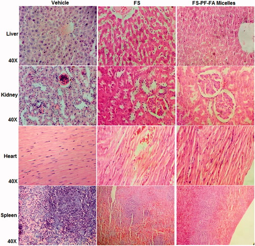 Figure 10. Tissue toxicity assessment of FS and FS-PF-FA micelles (fisetin loaded folate-conjugated pluronic127 micelles) in rats. The histopathologic examination of tissue sections of liver, kidney, heart and spleen was made after rats were sacrificed and staining with H and E stain; magnification 40X.