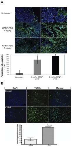 Figure 4 Apoptotic activity of (A) GP formulations and (B) camptothecin formulations using Tunel assay in neuroblastoma tissue harvested at 21 days after treatment.Notes: Green represents positive apoptotic cells and blue represents the DAPI nuclei stain. Magnification 100× (left column) or 200× (right column); n = 5, *P < 0.05 for 4 mg/kg or 5 mg/kg of GPNP-PEG in comparison with untreated controls in Figure 4A.Abbreviations: GP, gold porphyrin; GPNP-PEG, gold porphyrin nanoparticles surface-coated with PEG.