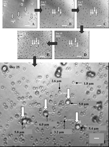 Figure 2 Optical micrograph of SF-CNP showing an increase in number over a culture period of 25 days. (A) Day 1 at 900X magnification; (B–E) Days 2, 5, 10, and 25, respectively at 300X magnification. The white arrows in each image indicate the same large SF-CNP on the same spot throughout the experiment. (F) measurements of a few SF-CNP on Day 25 at 900X magnification. All particles seen in the images are the different sizes of SF-CNP. Bars: (A) = 15 μm; (B), (C), (D), and (E) = 30 μm; (F) = 5 μm.Abbreviation: SF-CNP, serum-free calcifying nanoparticles.