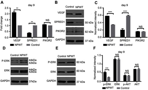 Figure 7 (A) qRT-PCR analysis of VEGF, SPRED1 and PIK3R2 gene expression in the NPWT and control groups on day 9. GAPDH was used as an endogenous control. (B) Western blotting of VEGF, SPRED1 and PIK3R2 in granulation tissue in the control and NPWT group on day 9. (C) Quantification of VEGF, SPRED1 and PIK3R2 protein expression in the NPWT versus control group on day 9. (D and E) Western blotting of p-ERK, ERK, p-AKT and AKT in wound healing tissue of the control and NPWT group on day 9. (F) Quantification of protein expression levels of p-ERK, ERK, p-AKT and AKT in the NPWT group versus control group on day 9. Proteins were normalized to GAPDH on day 9, and values are reported as relative change compared with control. NS >0.05**P<0.01, ***P<0.001, ****P<0.0001.