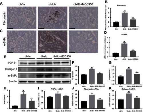 Figure 3 MCC950 alleviated renal fibrosis in db/db mice.