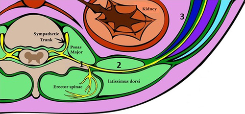 Figure 1 Animation of Transverse Section of Anatomical Targets of Regional Anesthesia Techniques for Cesarean Delivery. 1 –- Transverse process. 2 – Quadratus lumborum muscle. 3 – Abdominal wall muscles from deep to superficial: transversus abdominis, internal oblique, external oblique.