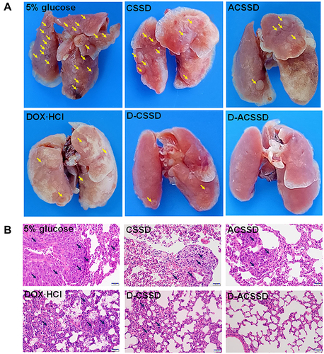 Figure 10 (A) Representative pictures of the lungs, and (B) H&E staining images of the lungs after administration of 5% glucose, DOX·HCl, CSSD, ACSSD, D-CSSD and D-ACSSD micelles in orthotopic 4T1-bearing mice. Yellow and black arrows represent lung metastases.