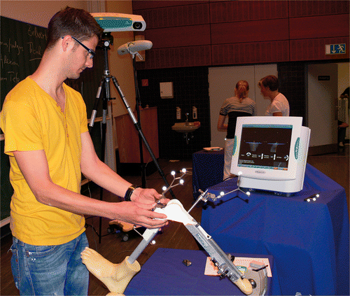 Figure 4. A student adjusts the cutting blocks using the Kolibri® device. During the procedure, an optical array was fixed on the tibial and femoral cutting blocks.