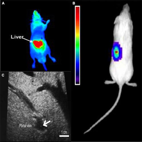 Figure 2 Islets transplantation imaging of FI, BLI and US. (A) Transplanted rat islets were detected by PiF fluorescence imaging. Reprinted with permission from Kang NY, Lee JY, Lee SH, et al. Multimodal imaging probe development for pancreatic β cells: from fluorescence to PET. J Am Chem Soc. 2020;142(7):3430–3439. Copyright (2020) American Chemical Society.Citation79 (B) 500 human islets were transduced with Adeno-CMV-Luc and implanted under the left kidney capsule of NOD-SCID mice. A representative CCD image 3 days postimplantation is shown. Reprinted from Mol Ther. 9(3). Lu Y, Dang H, Middleton B, et al. Bioluminescent monitoring of islet graft survival after transplantation.  428–435, Copyright 2004, with permission from Elsevier.Citation65 (C) Intraoperative ultrasound findings of the portal vein. The transplanted islets appeared as hyperechoic clusters in the portal vein (arrows). Reproduced from Sakata N, Goto M, Gumpei Y, et al. Intraoperative ultrasound examination is useful for monitoring transplanted islets: a case report. Islets. 2012;4(5):339–342, reprinted by permission of the publisher (Taylor & Francis Ltd, hhtp://www.tandfonline.com).Citation70