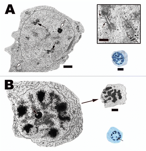 Figure 12 (A) Leptotene spermatocyte within the testis of the Black Swamp Snake (Seminatrix pygaea). The nucleus and the entire cell is now round as it has traveled away from the basal lamina. Linear densities (beginning of chromosome condensation) (black arrows) are common within the nucleus under the electron microscope and they appear as bundles of filaments when viewed via light microscopy. (B) Zygotene spermatocyte within the seminiferous epithelium of the European Wall Lizard (Podarcis muralis). Synaptonemal complexes (black arrows) start to form during this phase of meiosis. These complexes are where crossing over takes place. The formation of these complexes along with the progression of DNA condensation leads to thicker chromatin fibers within these spermatocytes under the light microscope. Light: Bar = 15 µm, TEM: Bar = 5 µm.