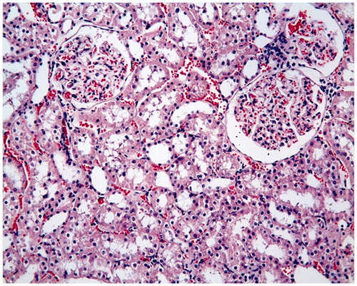 Figure 1. Control group: proximal tubules, distal tubules and glomerular structures are observed in normal histological state, H–E; ×20.