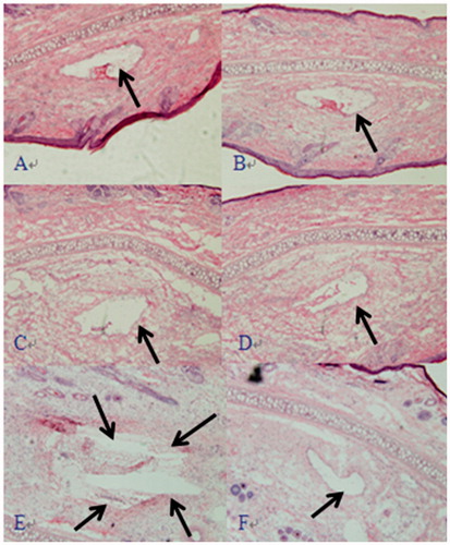 Figure 5. Representative photomicrographs of vein damage caused by injection GNA-PEG–NLC (A), Blank PEG NLC (B), GNA-NLC (C), Blank NLC (D), GNA-solution (E), and PEG200 + 0.9% NaCl solution (F) (×100).