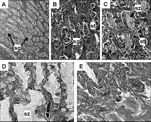 Fig. 3  Photomicrographs of testes at different developmental stages in Seriola lalandi: (A) spermatogonia proliferation stage; (B) early spermatogenesis stage; (C) late spermatogenesis stage; (D) functional maturation stage; (E) post-spawning stage. sg, spermatogonial; st, spermatid; sz, spermatozoon. Scale bar equals 100 µm.