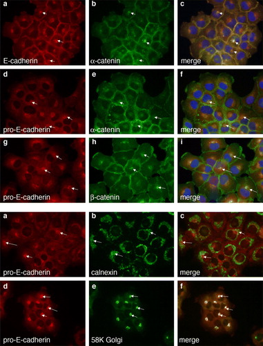 Figure 5.  Colocalization of pro-E-cadherin with catenins. Dual-color immunofluorescence colocalization was performed on A431DE cells grown on glass coverslips. (A) Cells were stained with rabbit polyclonal anti-E-cadherin together with 1G5 mouse monoclonal anti-α-catenin (a–c); rabbit polyclonal anti-pro-E-cadherin together with 1G5 mouse monoclonal anti-α-catenin (d–f); or rabbit polyclonal anti-pro-E-cadherin together with 15B8 mouse monoclonal anti-β-catenin (g–i). B. Cells were stained with rabbit polyclonal anti-pro-E-cadherin together with mouse monoclonal anti-calnexin (a–c), or rabbit polyclonal anti-pro-E-cadherin together with mouse monoclonal anti-58K Golgi marker (d–f). Secondary antibodies were Alexa Fluor 488 anti-mouse IgG (green) and Alexa Fluor 594 anti-rabbit IgG (red).