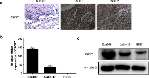 Figure 1. CXCR7 was highly expressed in EC. (a) The expression of CXCR7 in normal esophageal squamous epithelium and esophageal squamous cell cancer was detected by IHC. (b, c) The mRNA and protein level of CXCR7 in Eca-109, CaEs-17 and HEEC cells. **P < 0.01.