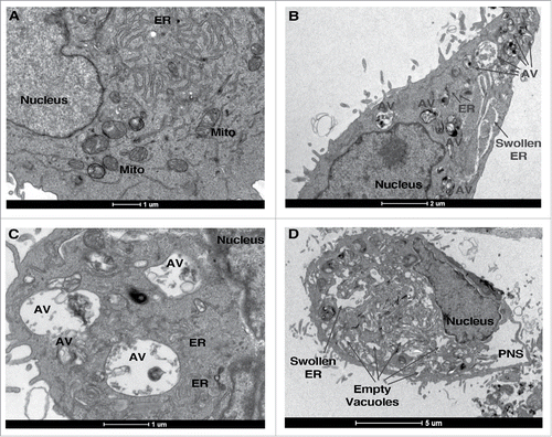 Figure 1. Resveratrol induces excessive autophagy in A549 cells. A. Transmission EM of control A549 cells. B-D. Transmission EM of A549 cells treated with 200 µM RSV for 48 h. AV, autophagic vacuoles, mito, mitochondria, PNS, perinuclear space.