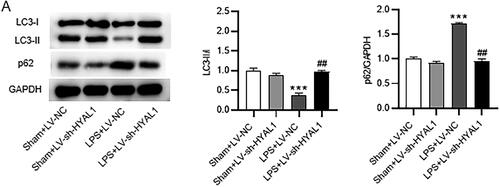 Figure 6. HYAL1 deficiency induced autophagy in LPS-induced AKI mice. (A) Western blotting for the protein levels of LC3‑II/I and p62 in murine renal tissues of Sham + LV-NC, Sham + LV-sh-HYAL1, LPS + LV-NC and LPS + LV-sh-HYAL1 groups. N = 10 mice each group. ***p < .001 vs. Sham + LV-NC group; ##p < .01 vs. LPS + LV-NC group.