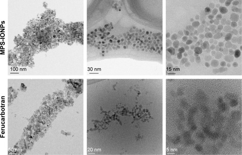 Figure 3 TEM analysis of MPS-IONPs and Resovist (ferucarbotran).Note: The diameter of a single particle was determined to be 11.5±1.3 nm and 5.7±1.2 nm (n=30) for MPS-IONPs and ferucarbotran, respectively.Abbreviations: TEM, transmission electron microscopy; MPS, 3-methacryloxypropyltrimethoxysilane; IONPs, iron oxide nanoparticles.