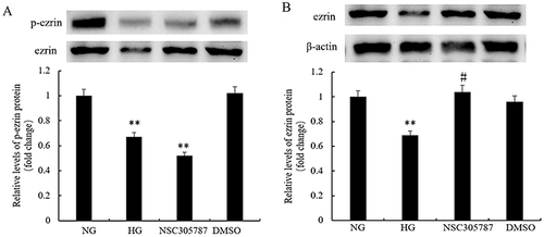 Figure 5 High glucose levels inhibit ezrin phosphorylation in human bronchial epithelial cells. The expression levels of p-ezrin and ezrin were detected using (A and B) Western blot analysis. BEAS-2B cells were treated with 3 μM of NSC305787 or vehicle control (DMSO) for 6 h at 37 °C and/or stimulated with normal glucose (NG, 5 mM), or high glucose (HG, 30 mM). The results were expressed as fold-change versus the NG group. **P<0.01, #P>0.05. Figure is representative of n=3.