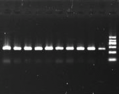 Figure 1.  The PCR products of POU1F1 gene. Lanes 1-10 = PCR amplification products of POU1F1 gene (451bp); Lane 11= maker (1200, 900, 700, 500, 300, and 100bp).
