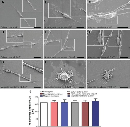 Figure 8 Representative SEM photomicrographs of SCs in each group at 24 hours after seeding.Notes: (A) Culture-plate group; (B) nonmagnetic membrane group; (C) magnetic membrane group; (D) culture plate + MF group (2.0 mT); (E) nonmagnetic membrane + MF group (2.0 mT); (F) magnetic membrane + MF group (2.0 mT); (G) dividing phase in magnetic membrane + MF group (2.0 mT); (H) magnetic membrane + MF group (5.0 mT); (I) magnetic membrane + MF group (10.0 mT). (J) The dendritic length of SCs in each group was measured (n=20). Scale bar: (A, D, E, G) 20 µm, (B, F, I) 15 µm, (C) 10 µm, (H) 5 µm.Abbreviations: SCs, Schwann cells; MF, magnetic field.