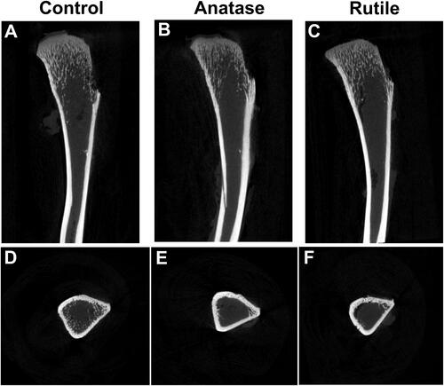 Figure 4 Non-reconstructed images of tibia. (A) Sagittal image of bone in the control group. (B) Sagittal image of bone in the anatase TiO2 NP group. (C) Sagittal image of bone in the rutile TiO2 NP group. (D) Cross-sectional image of bone in the control group. (E) Cross-sectional image of bone in the anatase TiO2 NP group. (F) Cross-sectional image of bone in the rutile TiO2 NP group.