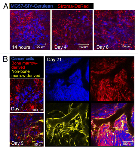 Figure 2. Longitudinal visualization of tumor stroma formation. (A) MC57-SIY-Cerulean cells were injected into a DsRed Rag1−/− mouse. Images were taken 14h, 4d, and 8d post window and cancer cell implantation. While 14h after window/cancer cell implantation, the site is densely infiltrated with round, rapidly moving stromal cells (image corresponds to Video 1), 4–8d later the number of these cells is greatly reduced and many stromal cells acquire a stellate and spindle-like shape (image corresponds to Video 2). (B) Tumor growth in color-coded bone-marrow (BM) chimeric mice with cerulean-blue tumor cells, DsRed BM-derived host cells, and EYFP-yellow non-BM-derived host cells. Cancer cells mobilize BM-cells and non-BM cells for the formation of tumor stroma. Non-BM-derived cells account mainly for tumor vasculature. Data are representative of 3 independent experiments.